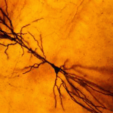 Neural Networks