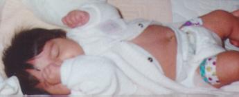 Four bandages on the legs